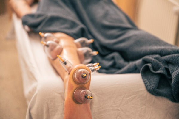 Cupping -& dynamisk cupping