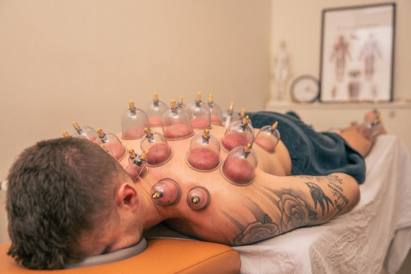 Cupping -& dynamisk cupping
