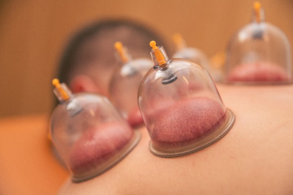 Cupping -& dynamisk cupping